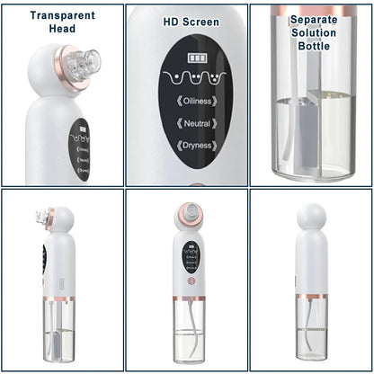 Blackhead Remover Vacuum – Electric Pore Cleaner with Strong Suction