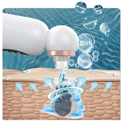 Blackhead Remover Vacuum – Electric Pore Cleaner with Strong Suction