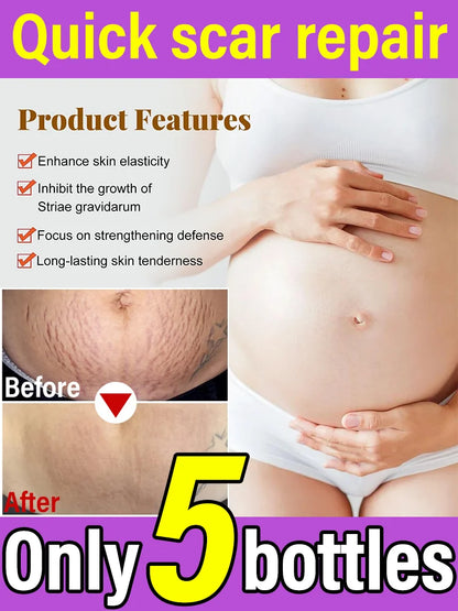 Body Essential Oil – Safe for Pregnancy, Moisturizes & Reduces Strets