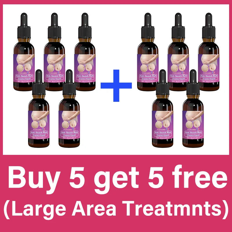 Body Essential Oil – Safe for Pregnancy, Moisturizes & Reduces Strets