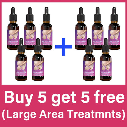 Body Essential Oil – Safe for Pregnancy, Moisturizes & Reduces Strets