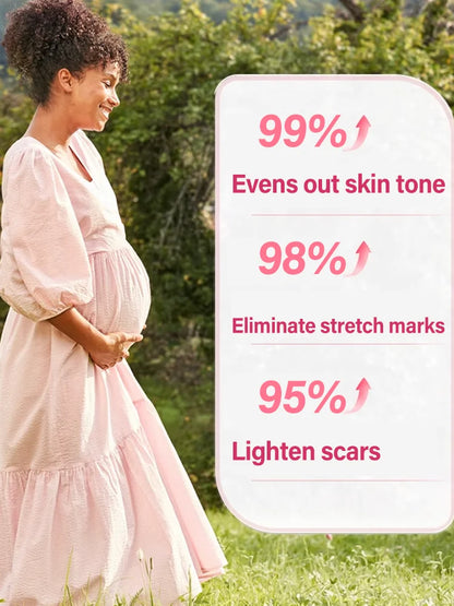 Body Essential Oil – Safe for Pregnancy, Moisturizes & Reduces Strets