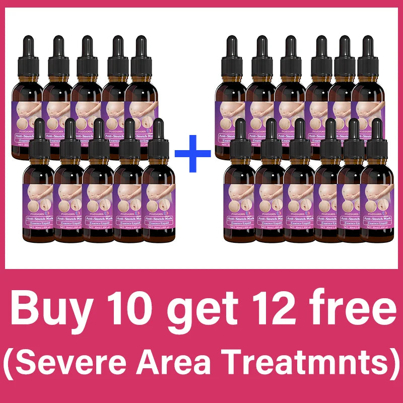 Body Essential Oil – Safe for Pregnancy, Moisturizes & Reduces Strets