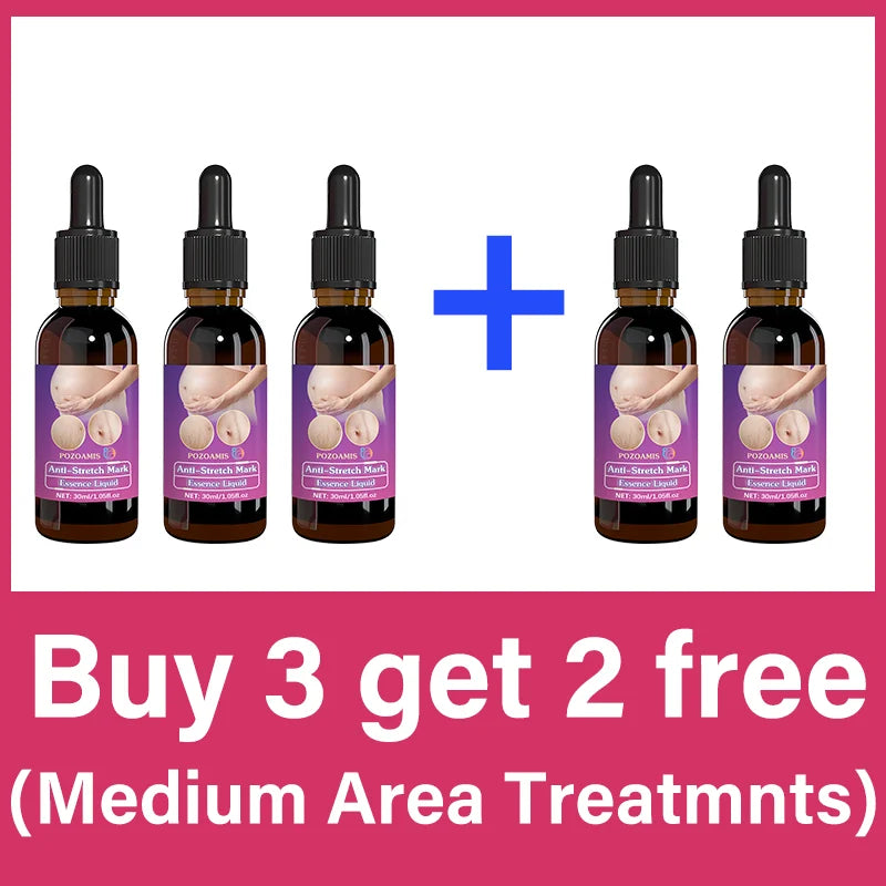 Body Essential Oil – Safe for Pregnancy, Moisturizes & Reduces Strets