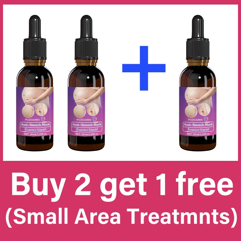 Body Essential Oil – Safe for Pregnancy, Moisturizes & Reduces Strets